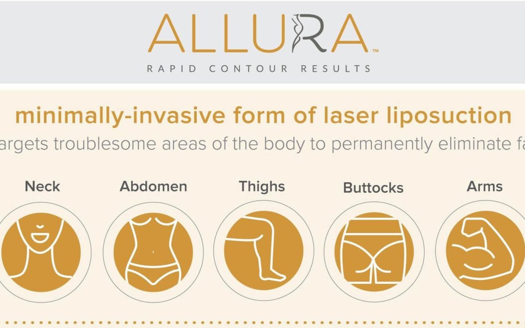 ALLURA Laser Liposuction Is Here!!