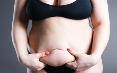 How Does a Tummy Tuck Remove Stubborn Belly Fat?