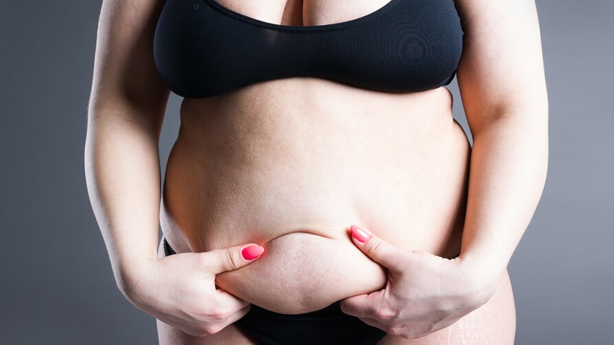 How Does a Tummy Tuck Remove Stubborn Belly Fat?