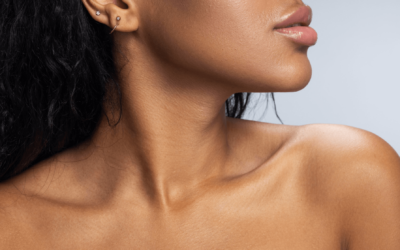 How Effective is KYBELLA for Stubborn Chin Fat?