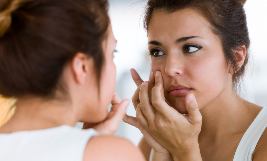 Your Guide to Acne Prevention and Maintenance