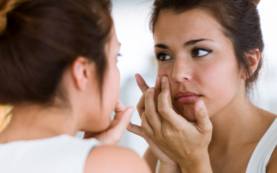 Your Guide to Acne Prevention and Maintenance